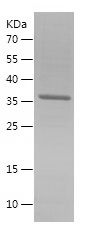 SDS-PAGE