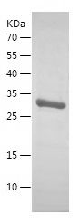 SDS-PAGE