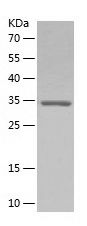 SDS-PAGE