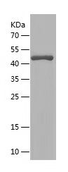 SDS-PAGE