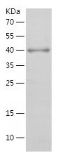 SDS-PAGE