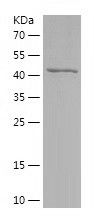 SDS-PAGE