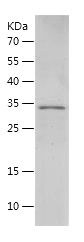 SDS-PAGE