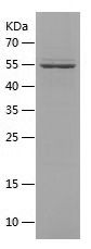 SDS-PAGE