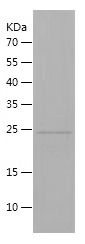 SDS-PAGE