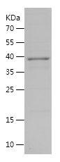 SDS-PAGE