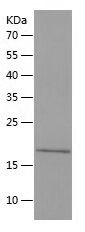 SDS-PAGE