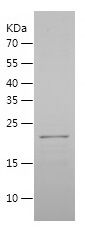 SDS-PAGE