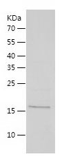 SDS-PAGE