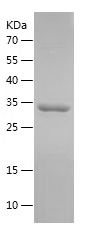 SDS-PAGE