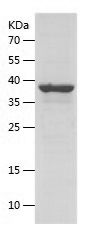 SDS-PAGE