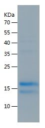 SDS-PAGE