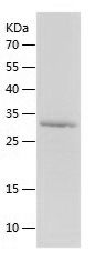 SDS-PAGE