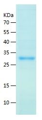 SDS-PAGE