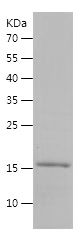 SDS-PAGE