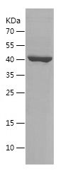 SDS-PAGE