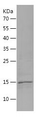 SDS-PAGE