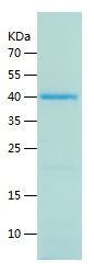 SDS-PAGE