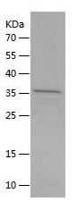 SDS-PAGE
