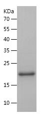 SDS-PAGE