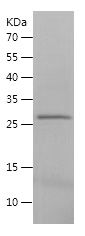 SDS-PAGE