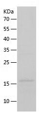 SDS-PAGE