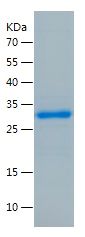 SDS-PAGE