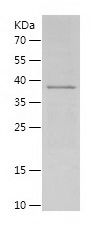 SDS-PAGE