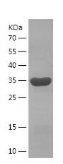 SDS-PAGE