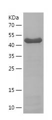 SDS-PAGE