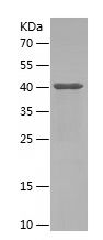 SDS-PAGE