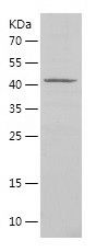 SDS-PAGE