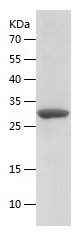 SDS-PAGE