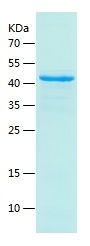SDS-PAGE