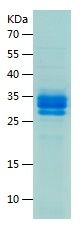 SDS-PAGE