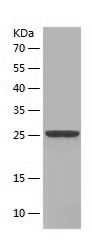 SDS-PAGE