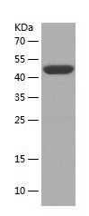 SDS-PAGE