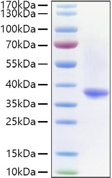 Recombinant Human IgG1 Protein