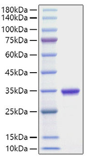 Recombinant Human IgG2 Protein