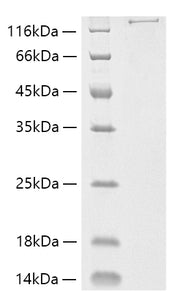 Recombinant Streptococcus pyogenes M1 Cas9 Protein