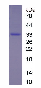 Figure 1. SDS-PAGE