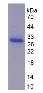 Figure 1. SDS-PAGE