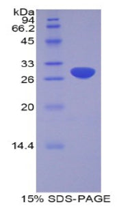 Figure 1. SDS-PAGE