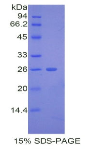 Figure 1. SDS-PAGE