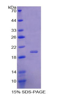 Figure 1. SDS-PAGE