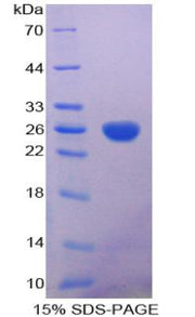 Figure 1. SDS-PAGE