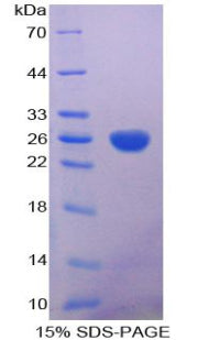 Figure 1. SDS-PAGE