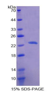 Figure 1. SDS-PAGE