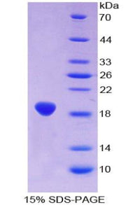 Figure 1. SDS-PAGE