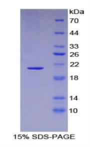 Figure 1. SDS-PAGE